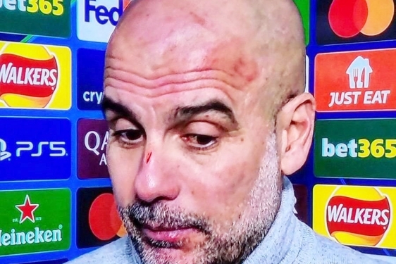 Otkriveno zbog koga se nervozni Pep Guardiola izgrebao po glavi