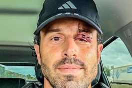 Fabio Grosso objavio fotografiju nakon što je stradao u autobusu Lyona