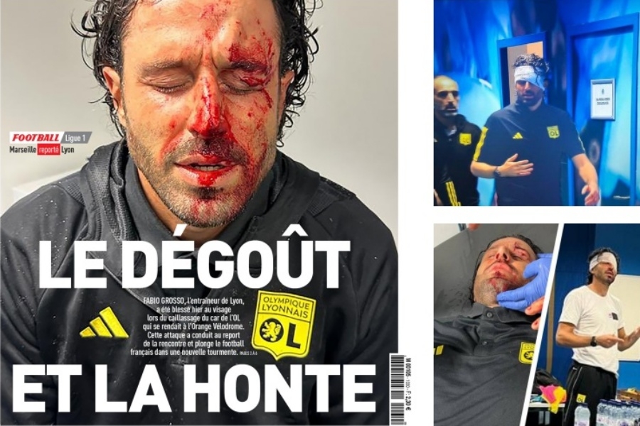 L'Equipe na naslovnici objavio fotografiju krvavog lica trenera Lyona