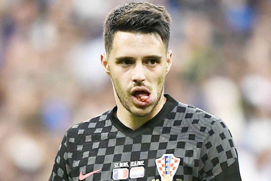 Zlatko Dalić: Brekalova pozicija je upražnjena, može se vratiti na najbolji način